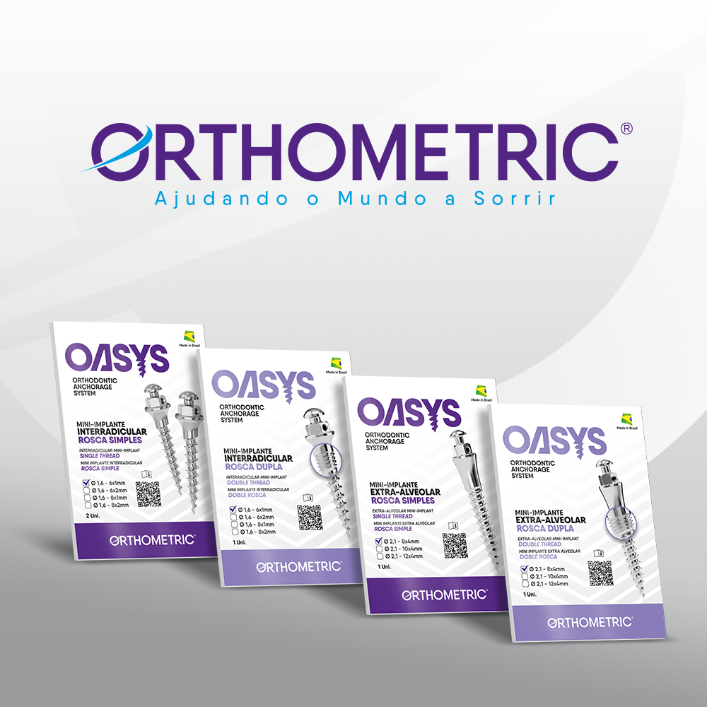 Mini-Implantes Ortodônticos