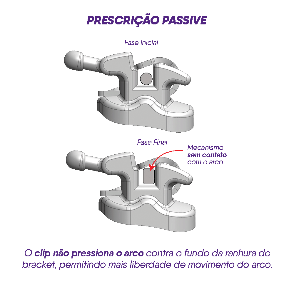 10.53.2300 – Bráquete Auto ligado de Aço Passivo U-Clip MBT 0,022 – 01 caso
