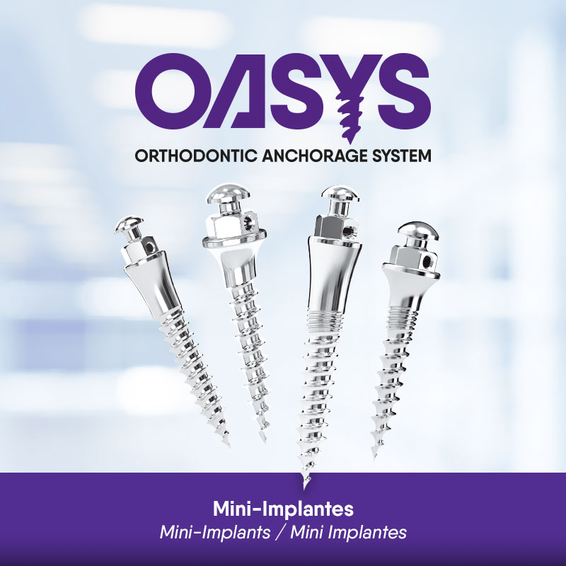 Mini-Implantes Ortodônticos OASYS